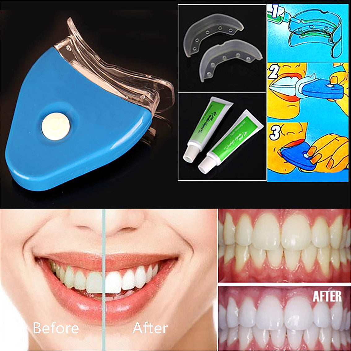 Oral Gel Teeth Whitening LED Kit